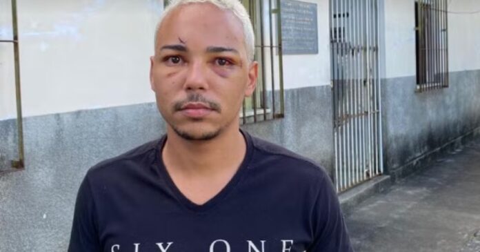 participante-de-evento-junino-no-sudoeste-baiano-relata-agressao-e-falta-de-socorro-em-festa