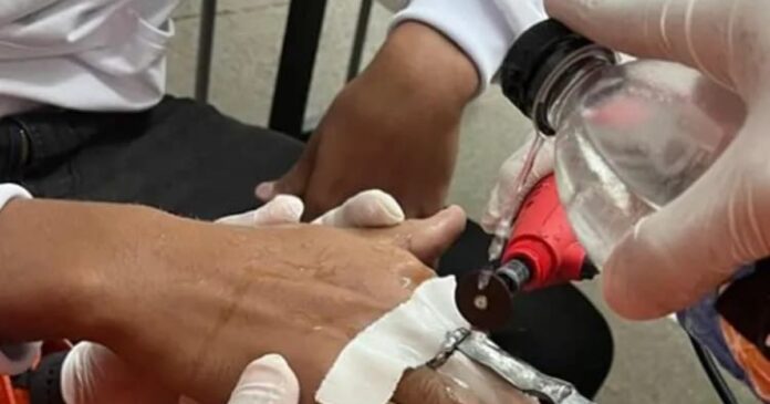 bombeiros-sao-acionados-para-retirar-anel-preso-em-dedo-de-adolescente-na-bahia