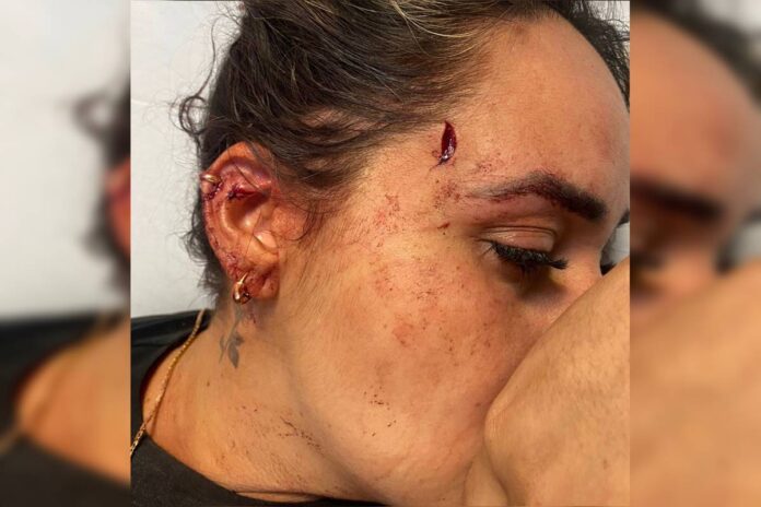 copo-quebrado-no-rosto-de-mulher:-video-mostra-inicio-de-confusao