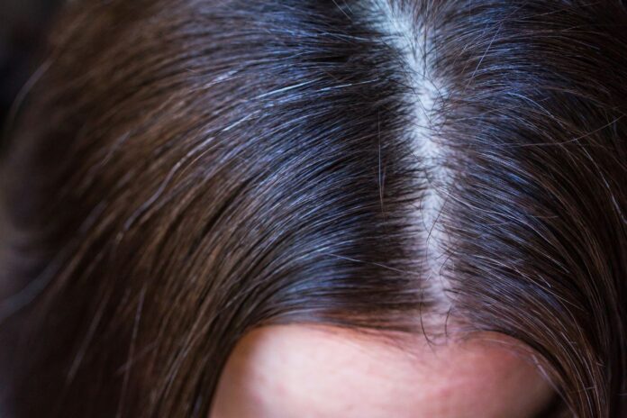 mulher-perde-cabelo-apos-fazer-alisamento-em-salao-de-beleza-do-df