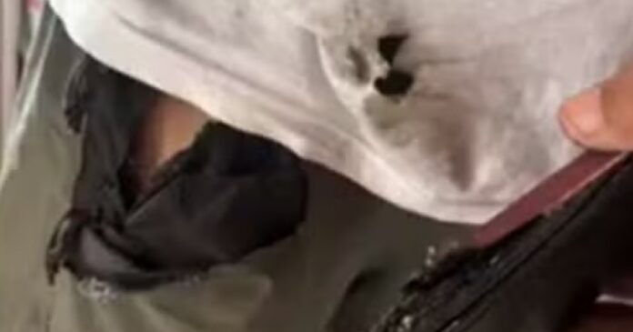homem-sofre-queimaduras-apos-celular-explodir-no-bolso;-caso-ocorreu-em-feira homem-sofre-queimaduras-apos-celular-explodir-no-bolso;-caso-ocorreu-em-feira