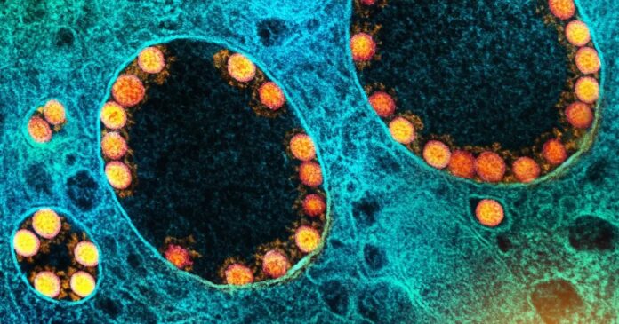 governo-australiano-apura-desaparecimento-de-centenas-de-amostras-de-virus-mortais