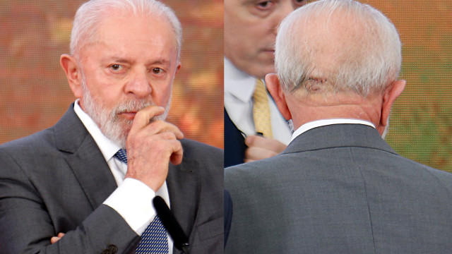 lula-continua-na-uti,-tirou-dreno-da-cabeca,-esta-lucido-e-orientado,-diz-boletim