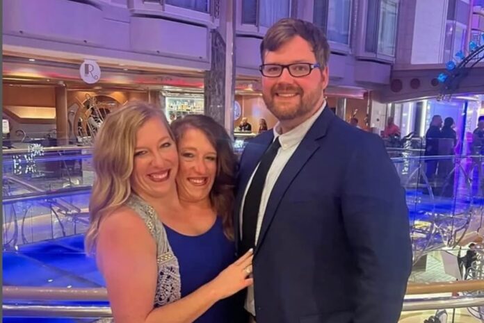 gemeas-siamesas-unidas-pelo-torax-anunciam-gravidez.-entenda-o-caso