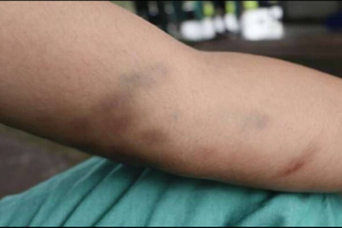 amarrados-e-trancados:-pacientes-viviam-terror-em-hospital-e-clinica