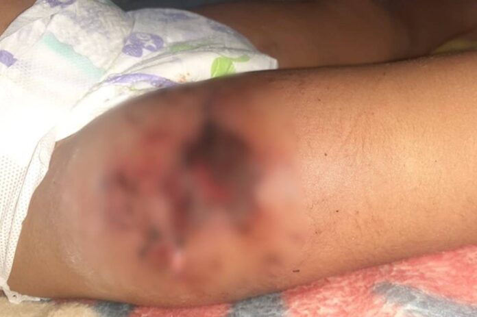 bebe-e-filho-de-deputado:-df-tem-historico-de-acidentes-com-fogos