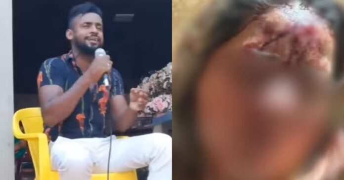 cantor-sertanejo-e-preso-apos-bater-cabeca-da-namorada-na-parede;-vitima-levou-pontos-na-testa