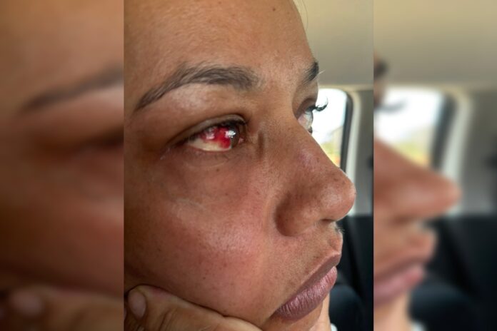 socos-e-tapas:-homem-passa-3-horas-agredindo-mulher-dentro-de-carro