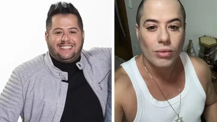 sertanejo-hugo,-da-dupla-com-tiago,-surge-bem-diferente-apos-harmonizacao