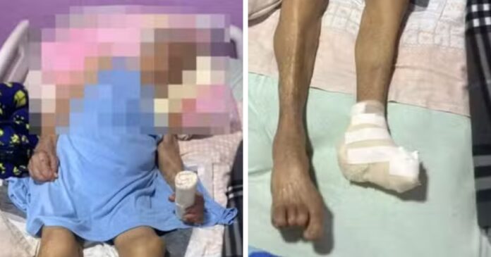 mulher-de-103-anos-tem-pe-amputado-sem-anestesia-por-enfermeira-no-df