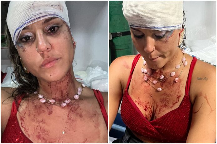 “apanhei-de-policiais”:-mulher-denuncia-agressao-em-bloco-de-carnaval