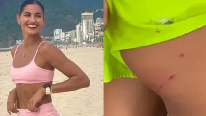 leticia-salles-e-atacada-por-cinco-cachorros-e-leva-mordida-no-bumbum