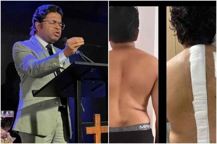impactante:-veja-o-antes-e-o-depois-da-cirurgia-do-pastor-nilson-gomes