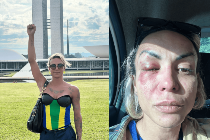 ativista-trans-relata-agressao-em-sp:-“tentativa-de-transfeminicidio”