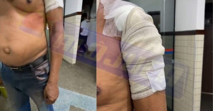 homem-e-baleado-durante-assalto-em-vila-de-abrantes