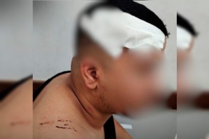 “mao-de-ferro”:-jovem-e-agredido-com-paulada-em-partida-de-truco-em-go