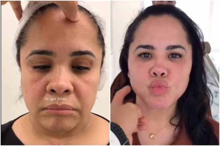 cassiane-surpreende-seguidores-com-transformacao-estetica-aos-52-anos