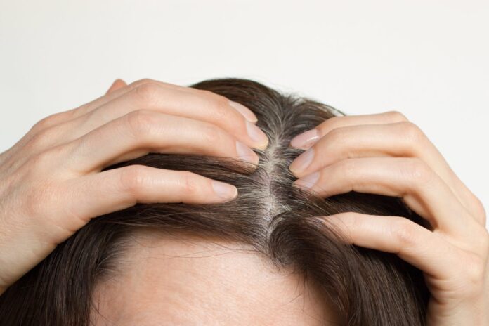 cabeleireiro-das-famosas-ensina-truque-para-disfarcar-cabelo-branco