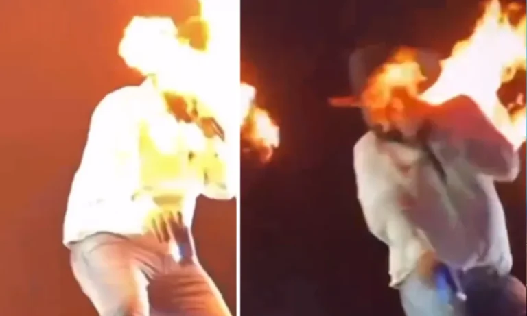 cantor-leo-fica-ferido-apos-ter-rosto-atingido-por-fogo-em-show;-video