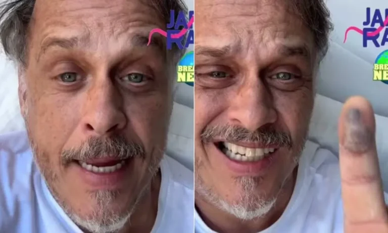 saiba-o-estado-de-saude-de-guilherme-fontes-apos-picada-de-jararaca