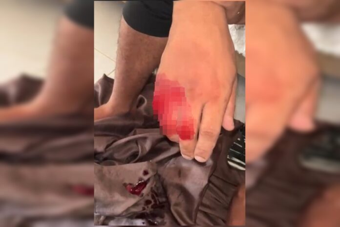 tribunal-do-crime:-ladrao-tem-dedo-cortado-por-faccionado-do-cdc.-veja
