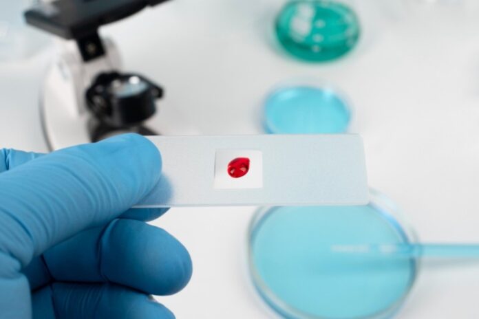 estudo-da-usp-identifica-proteinas-chave-para-tratamento-contra-cancer
