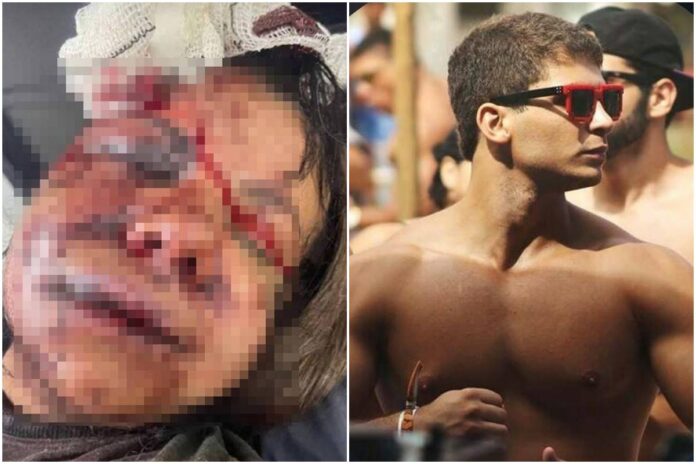 mulher-que-levou-60-socos-do-namorado:-“ele-disse-que-iria-me-matar”