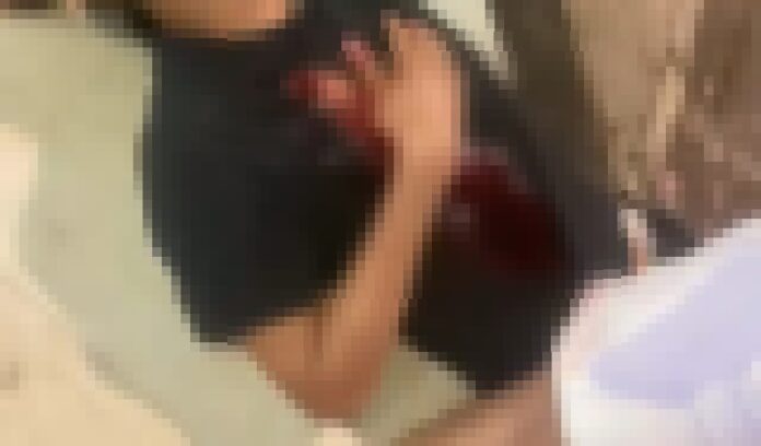 homem-e-esfaqueado-ao-tentar-separar-briga-em-itamaraju
