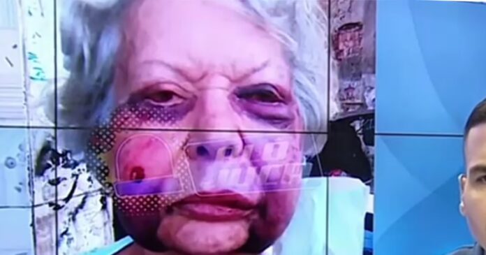 idosa-de-70-anos-e-espancada-apos-tentativa-de-assalto-dentro-da-propria-casa-na-lapinha,-em-salvador