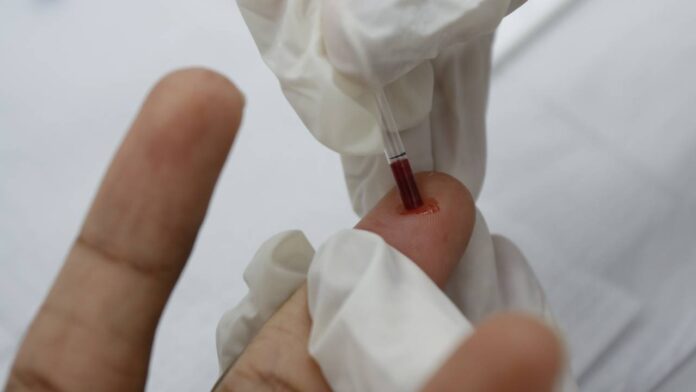 bahia-registra-aumento-de-hiv-no-publico-entre-10-e-19-anos-e-gera-alerta