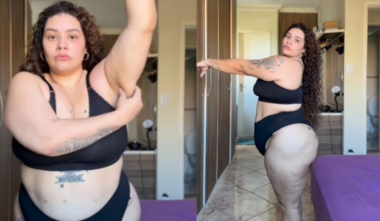 ex-the-voice,-aila-mostra-antes-e-depois-de-bariatrica:-‘flacidez’