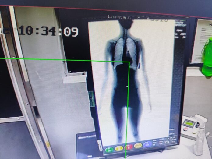 visitante-e-flagrada-pelo-bodyscan-tentando-entrar-em-presidio-de-eunapolis-com-drogas