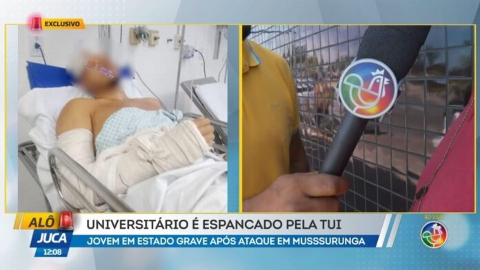 universitario-e-internado-em-estado-grave-apos-ser-espancado-por-integrantes-de-torcida-organizada-em-mussurunga