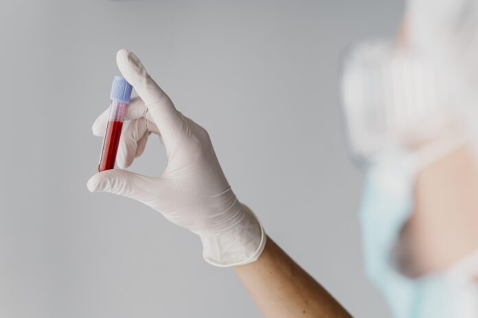 hiv-na-bahia:-sesab-desmente-surto-em-jovens-e-apresenta-dados