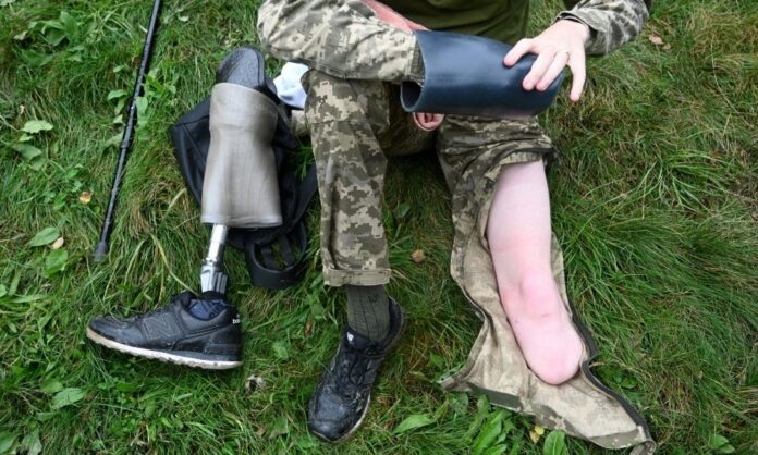 russia-se-orgulha-de-ser-lider-em-proteses-para-mutilados-apos-anos-de-conflito-na-ucrania