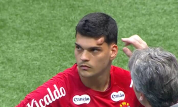 goleiro-do-santos-recebe-pancada-e-deixa-campo-em-ambulancia;-assista