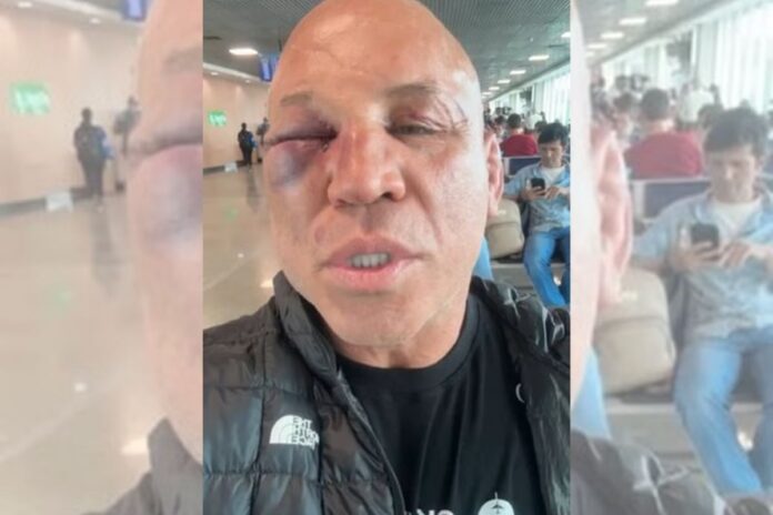 video:-wanderlei-silva-aparece-nas-redes-sociais-apos-ser-nocauteado