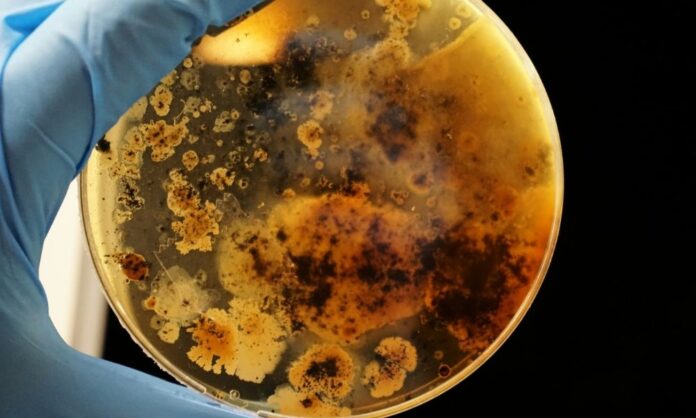 uma-em-cada-seis-infeccoes-bacterianas-no-mundo-e-resistente-a-antibioticos,-alerta-oms