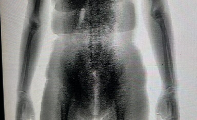 mulher-e-flagrada-com-drogas-nas-partes-intimas-ao-tentar-entrar-em-presidio-na-bahia