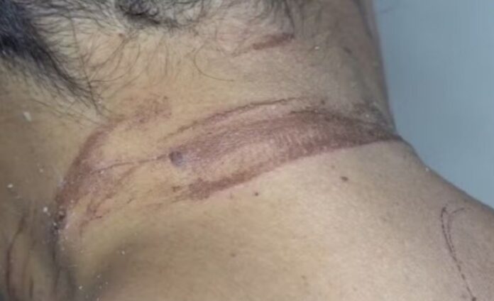mulher-denuncia-que-foi-enterrada-viva-pelo-ex-namorado-apos-tentativa-de-feminicidio