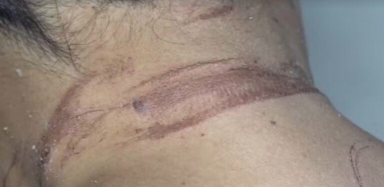 policia-apura-caso-de-mulher-enterrada-viva-pelo-ex-namorado-em-itabuna