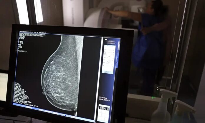 cancer-de-mama-segue-como-principal-causa-de-morte-por-neoplasias-entre-mulheres-na-bahia,-diz-levantamento