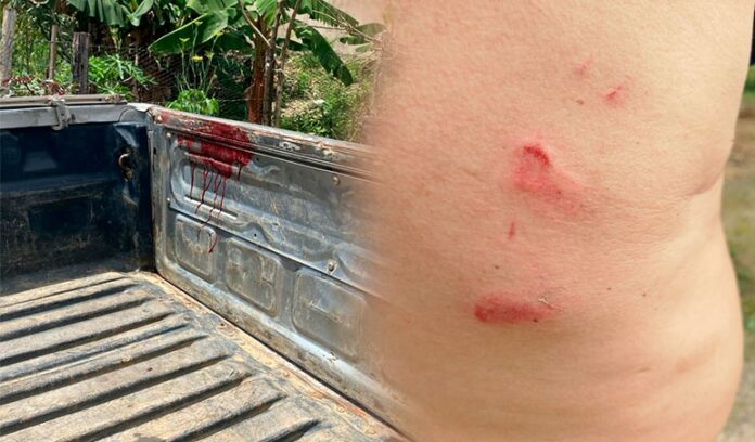 pai-e-filho-morrem-e-outro-homem-fica-ferido-durante-conflito-de-terra-no-extremo-sul-da-bahia pai-e-filho-morrem-e-outro-homem-fica-ferido-durante-conflito-de-terra-no-extremo-sul-da-bahia