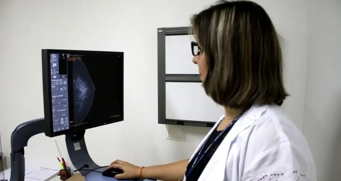 projeto-aprovado-na-camara-muda-legislacao-para-garantir-mamografia-no-sus-a-mulheres-a-partir-dos-40-anos projeto-aprovado-na-camara-muda-legislacao-para-garantir-mamografia-no-sus-a-mulheres-a-partir-dos-40-anos