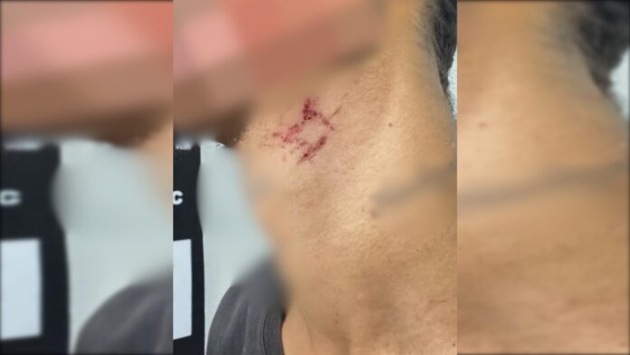 escravo-sexual-e-resgatado-apos-passar-mais-de-um-ano-em-carcere