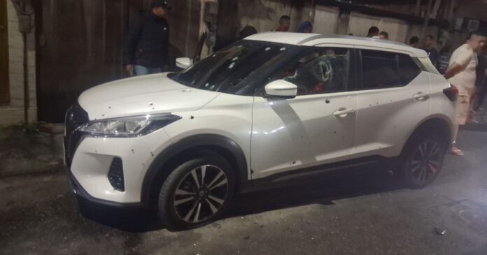 menina-de-11-anos-e-baleada-com-cinco-tiros-em-ataque-que-mirava-o-pai-no-rio menina-de-11-anos-e-baleada-com-cinco-tiros-em-ataque-que-mirava-o-pai-no-rio