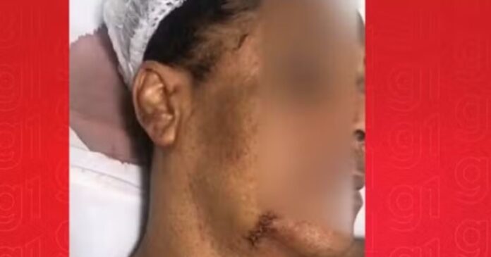 mulher-trans-acusa-tentativa-de-feminicidio-em-madre-de-deus;-companheiro-foi-detido