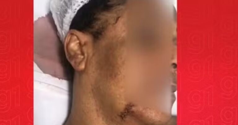 mulher-trans-acusa-tentativa-de-feminicidio-em-madre-de-deus;-companheiro-foi-detido