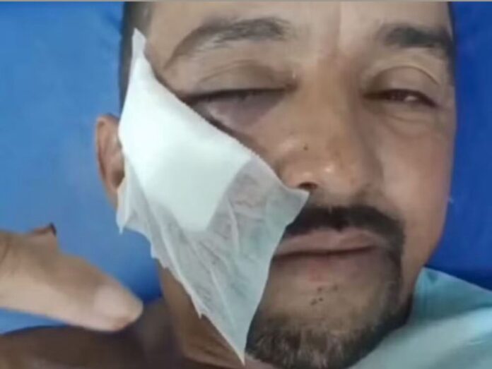 tijolada-no-rosto:-gari-e-agredido-por-morador-apos-briga-sobre-lixo