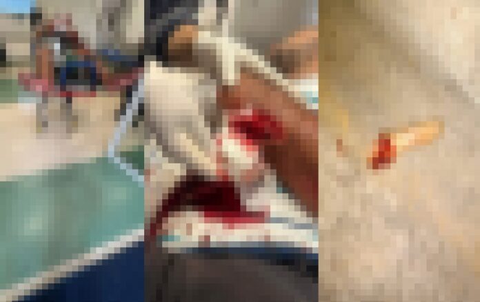 ciumes-em-boate-termina-em-tragedia:-homem-decepa-dedo-de-vitima-em-ataque-a-facao